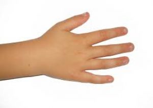 The Best Advice For Your Eczema Questions